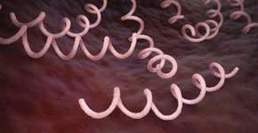 Foto: (iLexx/istock)