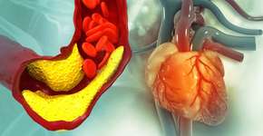 Foto: (Mohammed Haneefa Nizamudeen/istock)