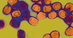 Cientistas fazem alerta sobre comportamento da nova cepa da mpox