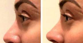 Foto: (reprodução/Instagram)