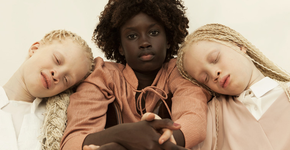 Beleza única: gêmeas albinas protagonizam ensaio inspirador