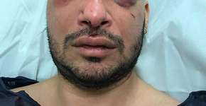 Foto: (Imagem sem texto alternativo disponivel ID [1348869])