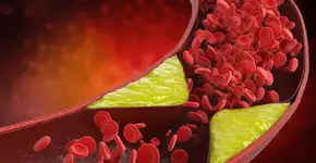 Foto: (PhonlamaiPhoto/istock)