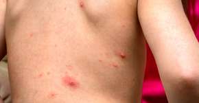 Foto: (_jure/istock)