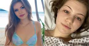 Influenciadora desenvolve coágulos após cirurgia estética na vagina