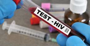 Brasil tem 135 mil pessoas que vivem com HIV e não sabem