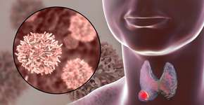 Foto: (Dr_Microbe/istock)