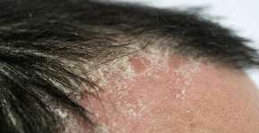 Foto: (Sergey Dogadin/istock)