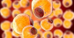 Quais são os 3 órgãos mais propensos a desenvolver câncer silencioso