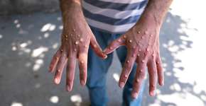 Foto: (Mustafa Kaya/istock)