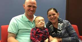 Mãe desabafa após filho com anomalia genética virar meme