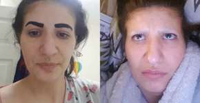 Em vídeo, britânica perde sobrancelhas após usar colorante