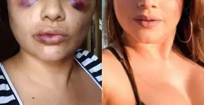 Influencer grava vídeo denunciando espancamento