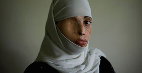 Foto: (Imagem sem texto alternativo disponivel ID [584579])