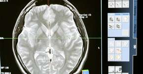 Descubra a idade real do seu cérebro com este teste fácil