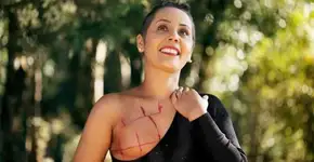 A beleza das mulheres em tratamento contra o câncer em fotos