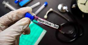 Foto: (olanstock/DepositPhotos)