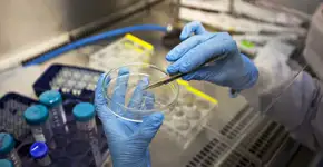 Terapia genética consegue remissão de câncer incurável