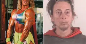 Mulher bombada fica com rosto masculino