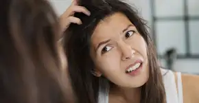 Como acabar com a caspa? Confira 6 receitas caseiras