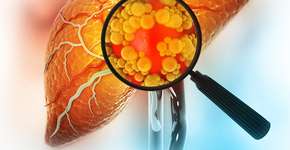 Foto: (Mohammed Haneefa Nizamudeen/istock)