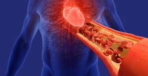 Estudo revela qual é o melhor exercício para baixar pressão alta