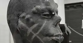 Diabão explica como ouve e usa óculos após remover orelhas