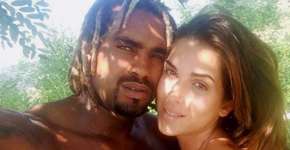 Miss pode ficar cega após ser atacada com ácido por ex-namorado