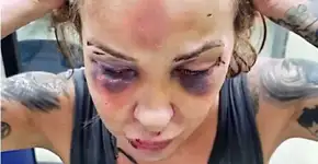 Mulher é torturada com soco inglês e cassetete por 3 dias pelo namorado