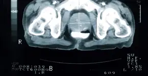 Foto: (iStock/jamesbenet)