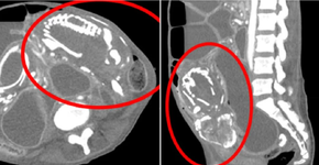 Foto: (reprodução/BMC Women\'s Health)