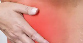 Alimentos que causam inchaço