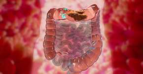 Foto: (Depositphotos/aamine29000)