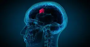 Sintoma persistente revela tumor cerebral em mulher de 39 anos