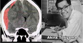 Foto: (Sopone Nawoot/istock/reprodução/instagram)