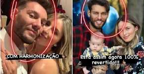 Lucas Lucco retira toda harmonização facial e mostra antes e depois