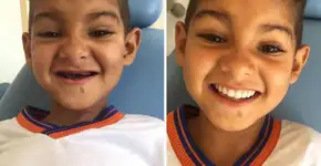 Dentista realiza sonho de menino que sonhava ter dentes de novo