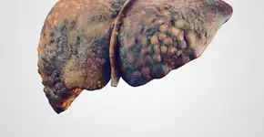 Foto: (eranicle/istock)