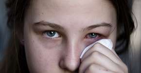 Como prevenir conjuntivite com medidas simples