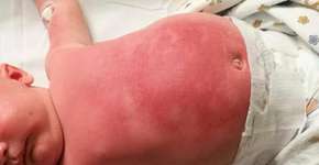 Foto: (Imagem sem texto alternativo disponivel ID [1187307])