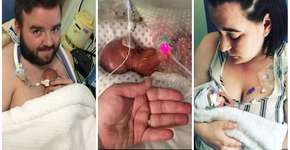 Bebê que nasceu de 22 semanas desafia prognóstico médico e evolui