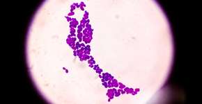 Foto: (Md Saiful Islam Khan/istock)