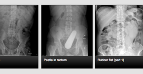 Foto: (Imagem sem texto alternativo disponivel ID [800927])