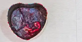 Foto: (Carla Raiter 2011)