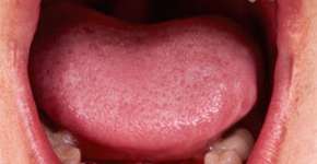 Foto: (Imagem sem texto alternativo disponivel ID [150848])