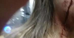 Foto: (Imagem sem texto alternativo disponivel ID [858964])