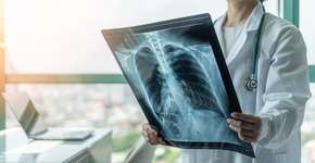 Sinal nas unhas levou este personal trainer a descobrir um câncer de pulmão