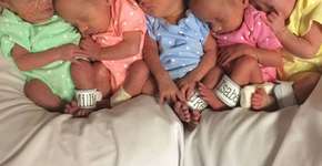 Mulher recebe ajuda de 24 profissionais para dar à luz quíntuplos