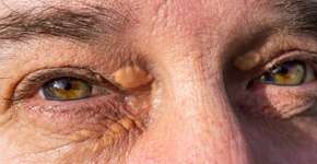 Foto: (Getty Images/iStockphoto)