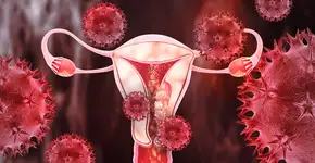 Os sinais comuns de câncer de útero que você nunca deveria ignorar